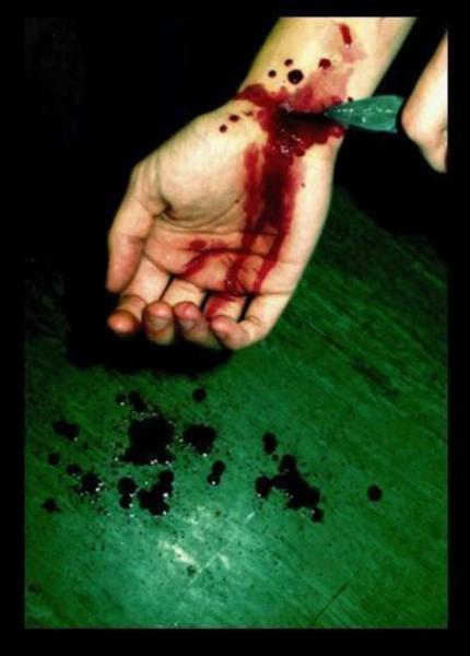 le suicide